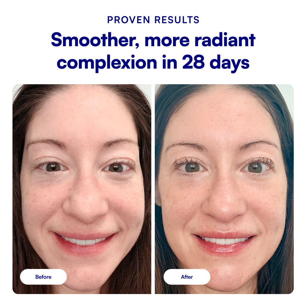 Before-and-after facial skin comparison of a woman's face, with text at the top reading 'PROVEN RESULTS' and 'Smoother, more radiant complexion in 28 days.'.